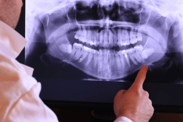 Best Emergency X-Rays and Diagnostics in Boswell, PA
